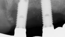 X01132 1 6067872186187 X01132 1 6067872186187