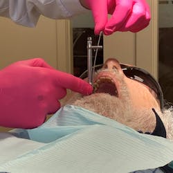 Figure 4c: This is another perspective of the ideal viewing angle for the clinician. Figure 4c: This is another perspective of the ideal viewing angle for the clinician.