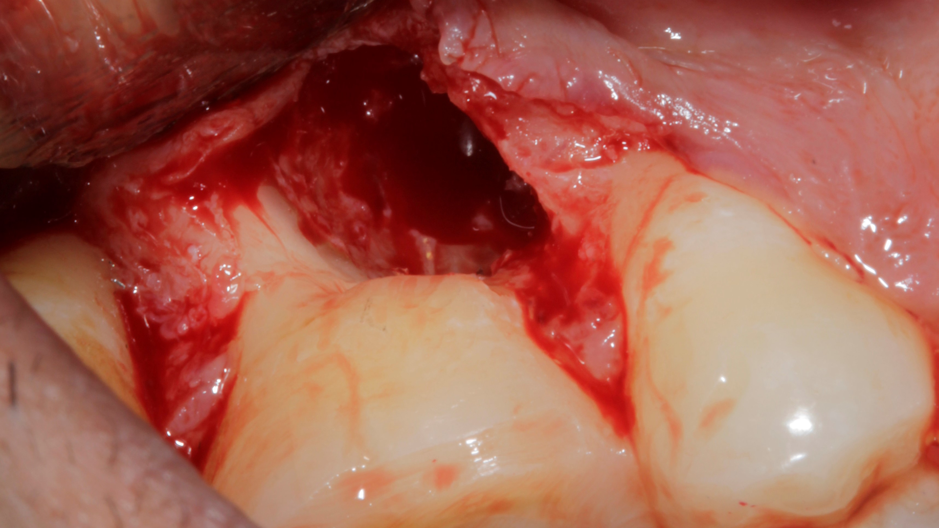 Figure 4 6099a2e8bca3a