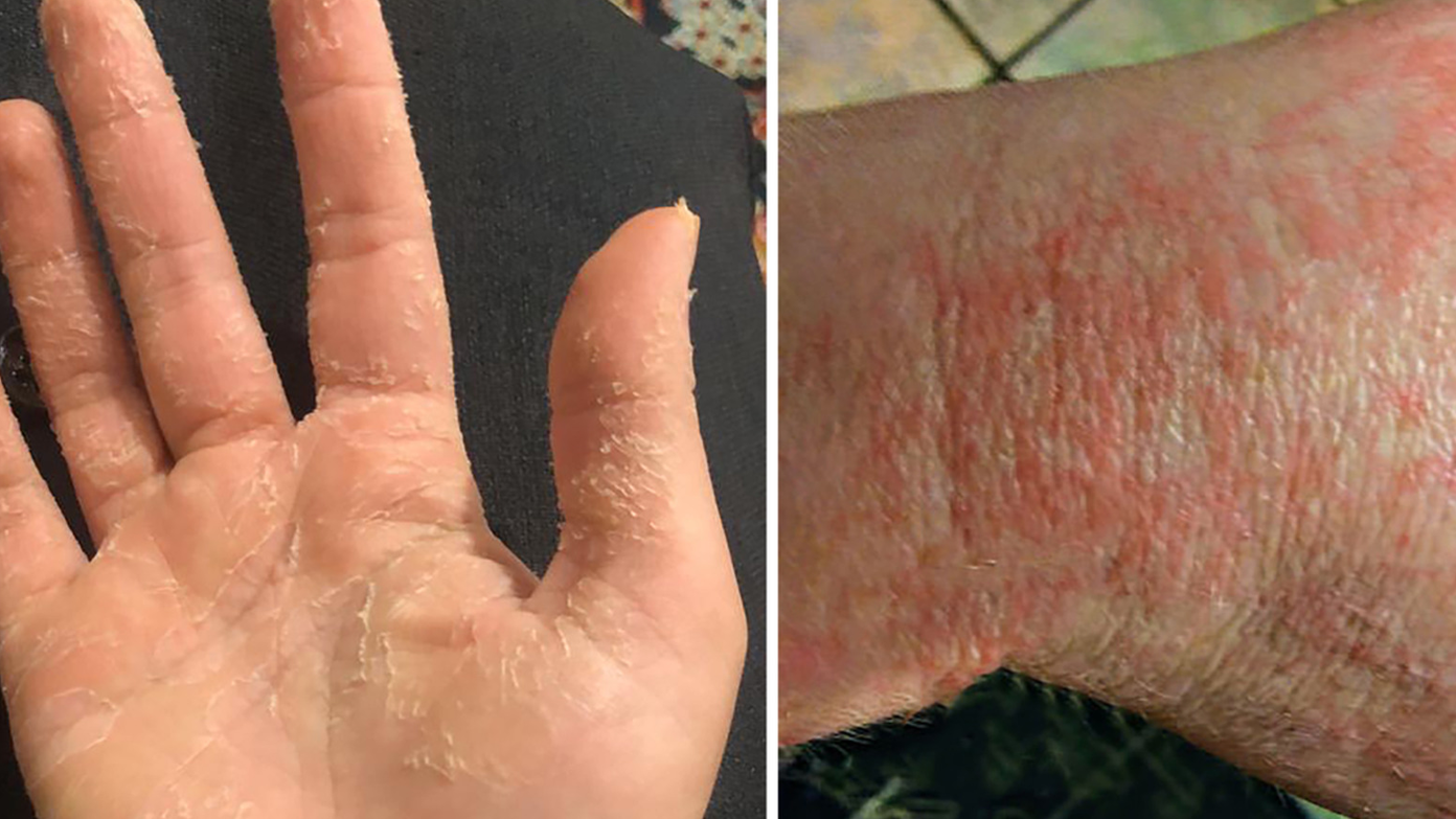 Figure1 60e483833e380