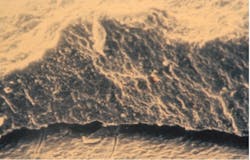 Figure 3: A scaling instrument easily lifts calculus off the root surface if the cemental mounds are the only means of retention. Figure 3: A scaling instrument easily lifts calculus off the root surface if the cemental mounds are the only means of retention.
