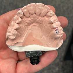 Figure 1: Distortion of a dental model due to material expansion Figure 1: Distortion of a dental model due to material expansion