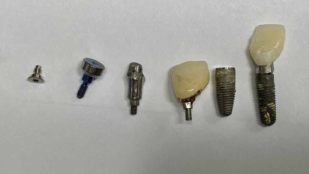 This month's clinical tip from the editor: 'Help! My implant fell out