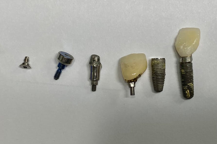 This month's clinical tip from the editor: 'Help! My implant fell out