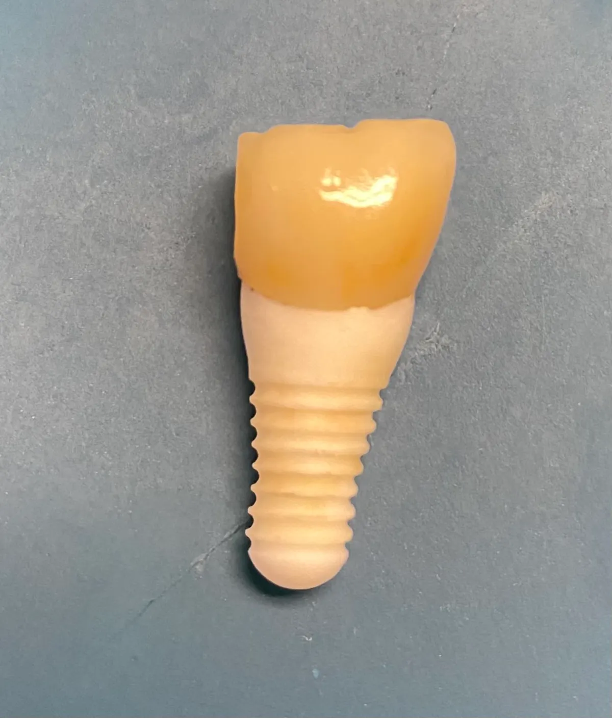 This month's clinical tip from the editor 'Help! My implant fell out