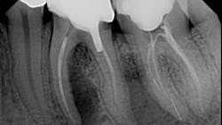 X06115 620bd1295aade X06115 620bd1295aade