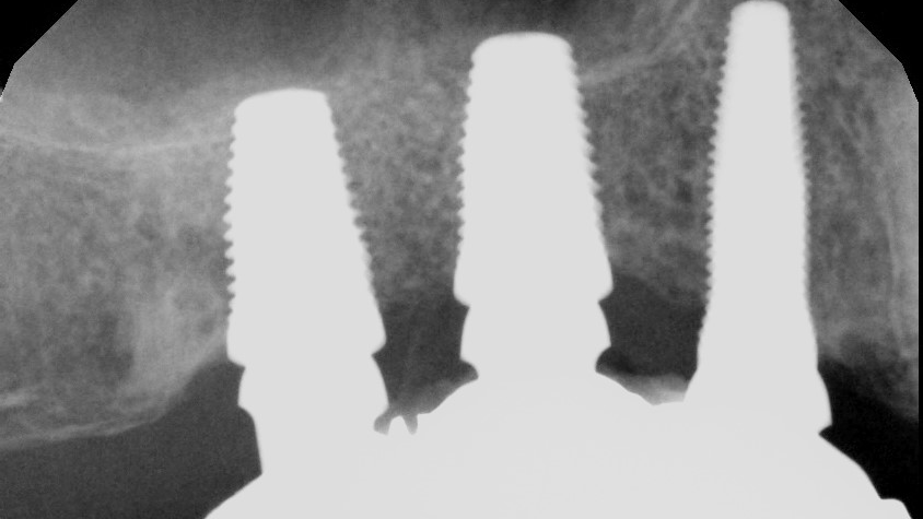 X00826 1 62278655d7f95