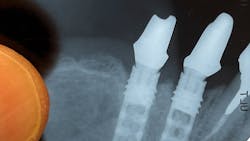 Image2 62797e2876cc9 Image2 62797e2876cc9