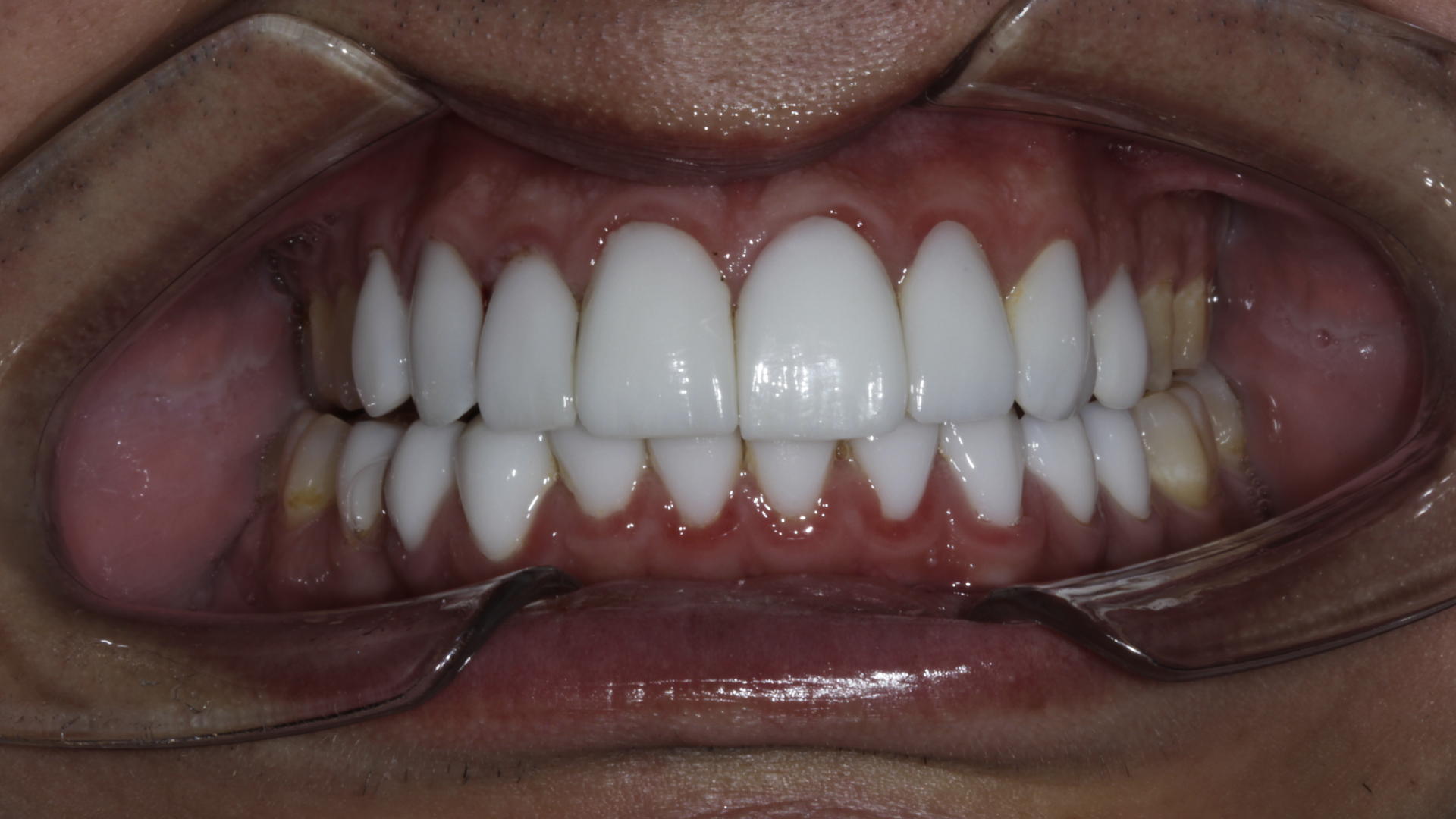 Mg 9695 629e61e93a841