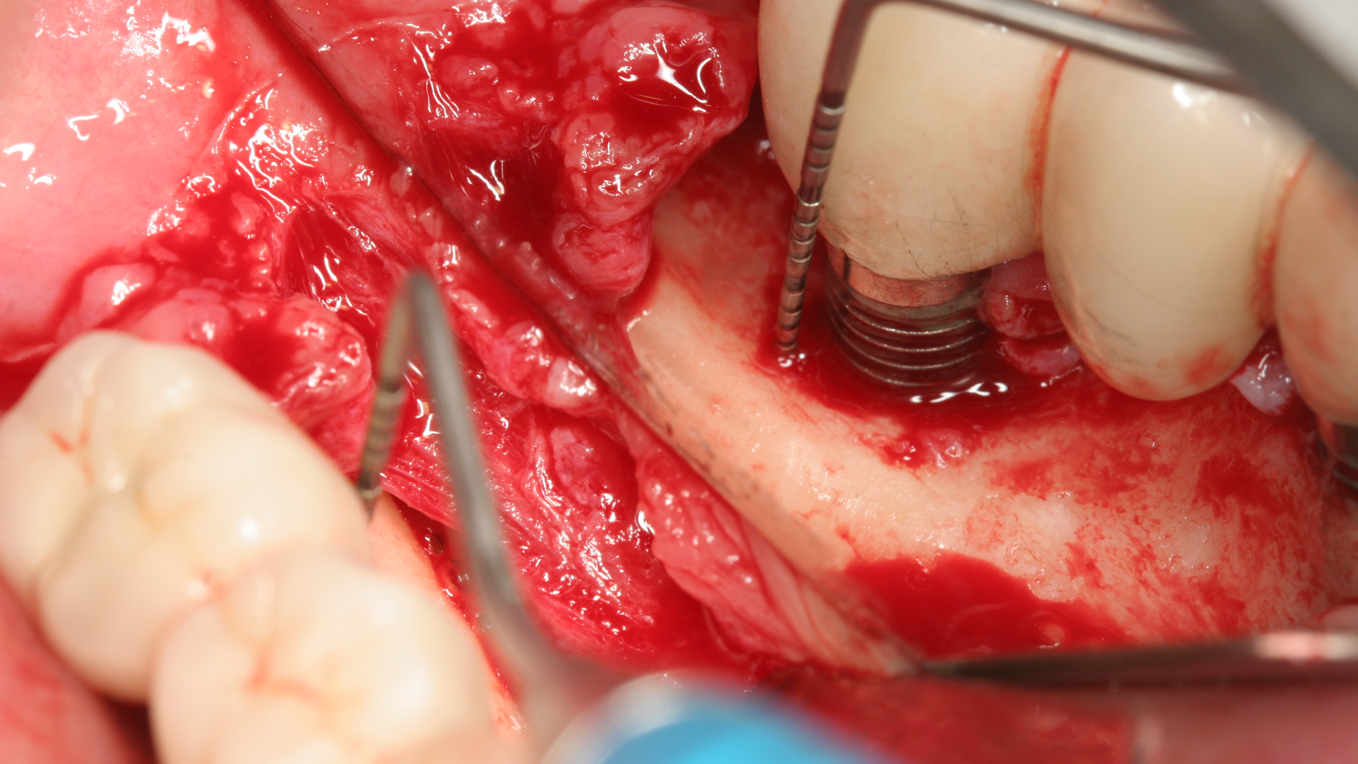 Figure3 629e5d08d1eef