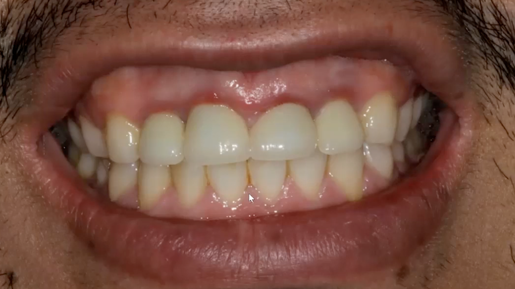 Screen Shot 2022 08 24 At 10 17 37 Am