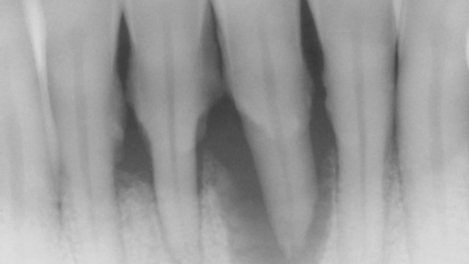 Fig1 X02523 3 6317bfb97be9a