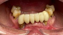 Fig 1 6344894055d39 Fig 1 6344894055d39