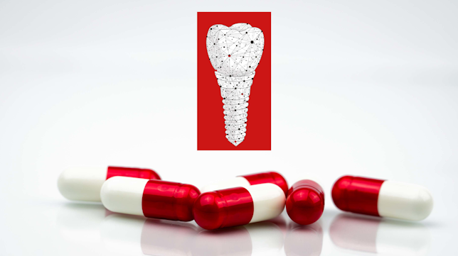 https://img.perioimplantadvisory.com/files/base/ebm/pia/image/2022/12/16x9/composite2.6388e7cf10cfc.png?auto=format%2Ccompress&w=320