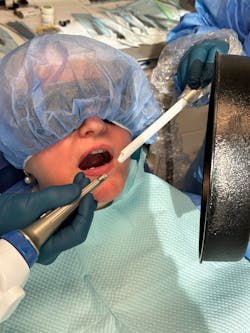 Figure 2: LLLT therapy Figure 2: LLLT therapy