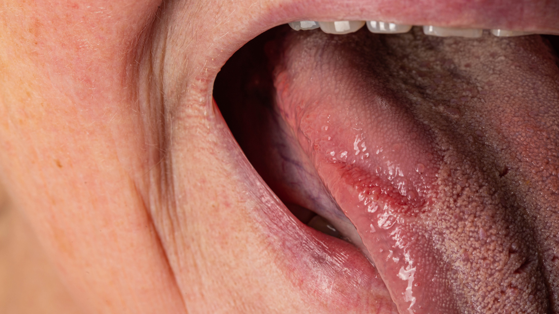 Dreamstime Xxl 254464253 64024ebb7b6f8