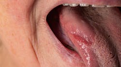 Dreamstime Xxl 254464253 Dreamstime Xxl 254464253