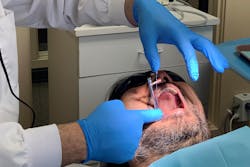 Figure 5: During activation, the cantilever beam cannot always be viewed at 90 degrees. The SmartMarker aids in viewing and records applied torque. Figure 5: During activation, the cantilever beam cannot always be viewed at 90 degrees. The SmartMarker aids in viewing and records applied torque.