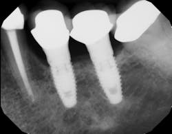 Figure 1: Initial x-ray of the case Figure 1: Initial x-ray of the case