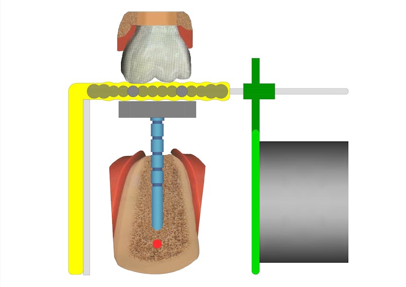 Figure 3: Appropriate beam alignment