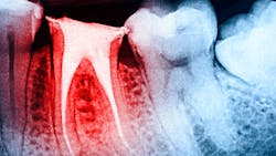 65c1608ea251b4001e7448c4 Dreamstime Xxl 68560230 65c1608ea251b4001e7448c4 Dreamstime Xxl 68560230