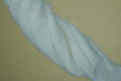 Figure 3c: Representative photograph at magnification of material found inside the implant