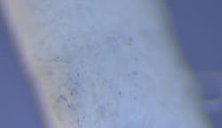 Figure 4: Paper point after removal from the implant shown in Figure 1. Fine particles of titanium were found. Figure 4: Paper point after removal from the implant shown in Figure 1. Fine particles of titanium were found.