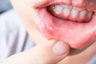 glutathione herpes Best Glutathione Supplement