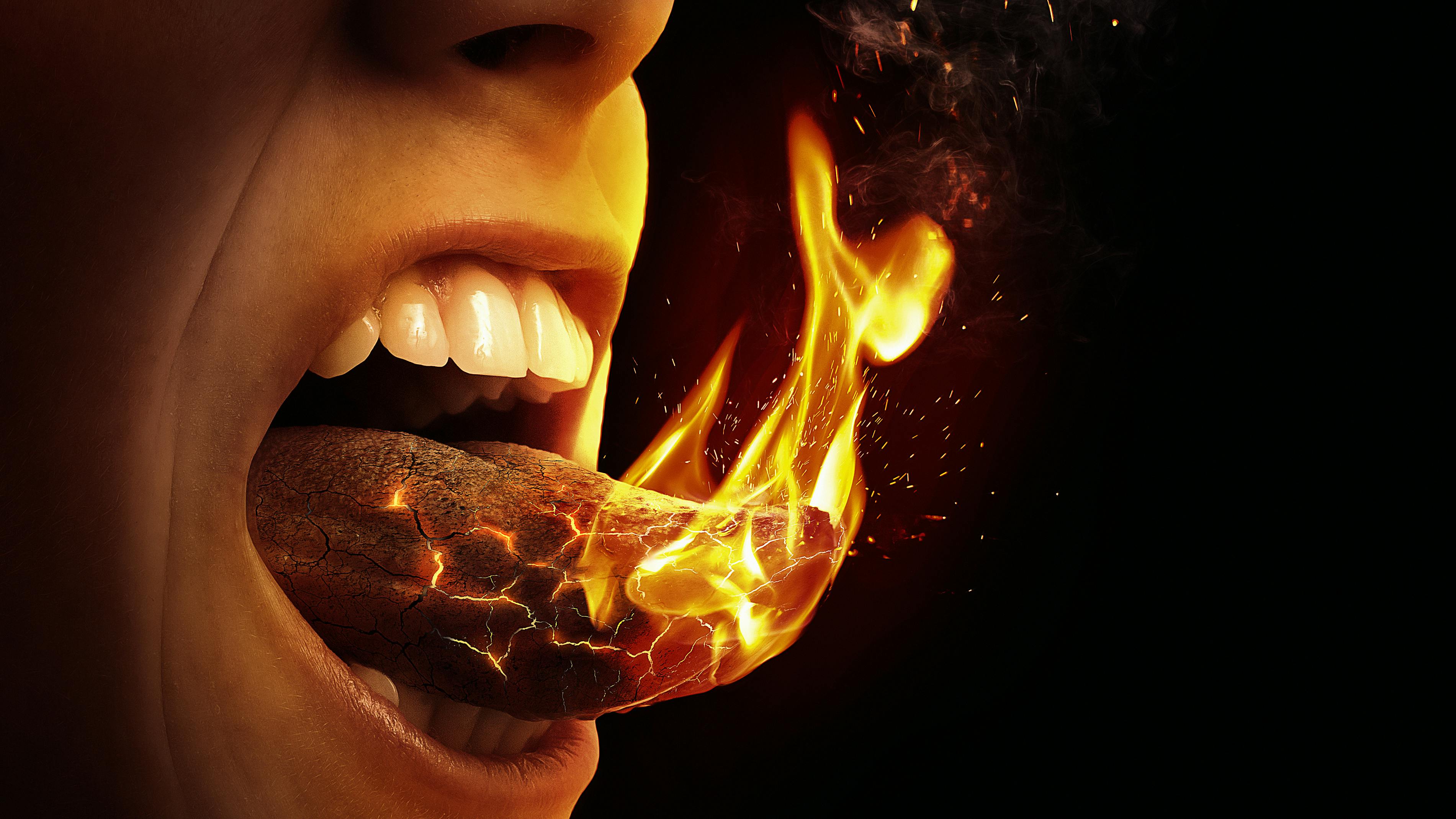 burning mouth syndrome