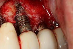 Figure 1: Corrosion Figure 1: Corrosion