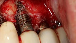 66fec49eb6dc627e60ceeab1 Figure1corrosion 66fec49eb6dc627e60ceeab1 Figure1corrosion