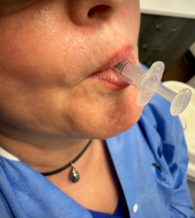 oral chromatography oral chromatography