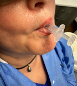 oral chromatography oral chromatography