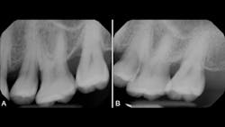 regenerative medicine regenerative medicine