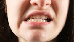 woman grinding her teeth woman grinding her teeth