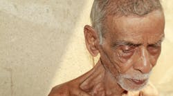 malnourished man malnourished man