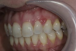 closeup of teeth closeup of teeth