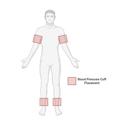 illustration of where to take blood pressure on the body illustration of where to take blood pressure on the body