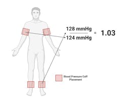 illustration of how to calculate blood pressure illustration of how to calculate blood pressure