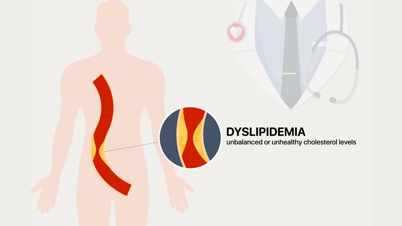 illustration of the effects of unhealthy cholesterol levels