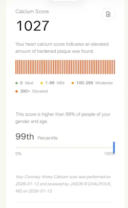 Figure 1: Coronary artery calcium score indicating high calcified plaque in the arteries Figure 1: Coronary artery calcium score indicating high calcified plaque in the arteries