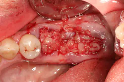 Figure 3E Figure 3E