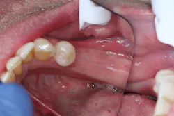 Figure 3H Figure 3H