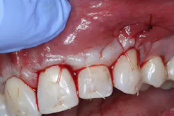 Figure 5B Figure 5B