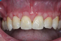 Figure 5D Figure 5D