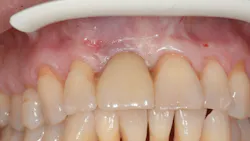 Figure 7D Figure 7D