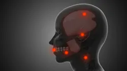 profile of a head noting temporomandibular joint (TMJ) myofascial pain and trigger points