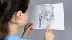 dental professional looking at an x-ray of the jaw
